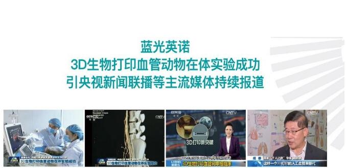 中国人体器官3D打印技术在全球取得瞩目成绩