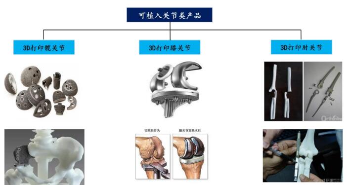 强强联手 华钛三维正式切入碳纤维医疗应用领城