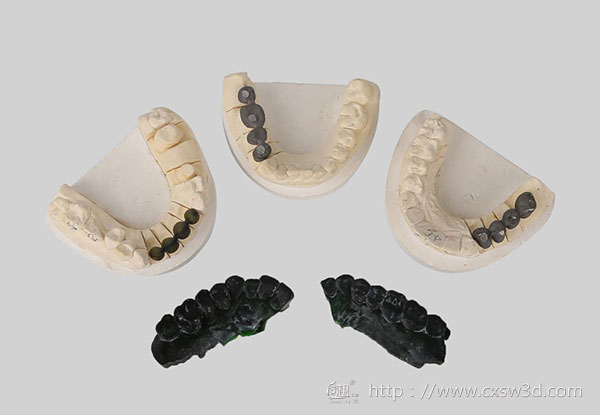3D打印技术融入医疗行业  为患者带来福音