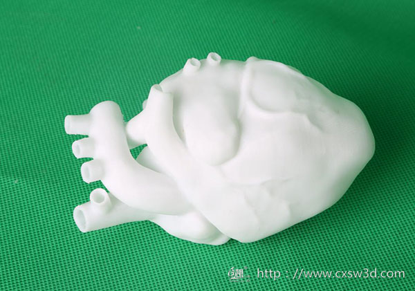 3D打印技术融入医疗行业  为患者带来福音