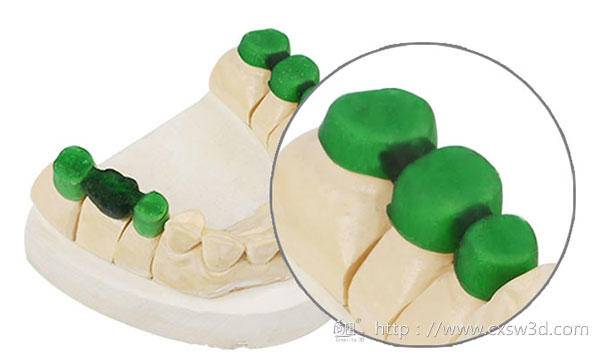 3D打印+医疗风起云涌，“看病难，看病贵”有望成为过去式？