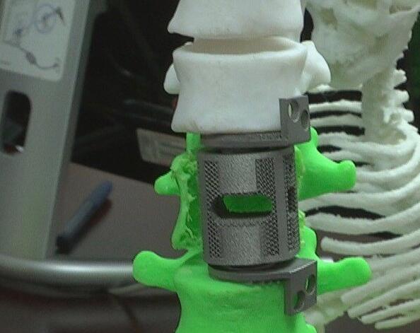 世界领先  西安交大3D打印重建脊柱脊髓