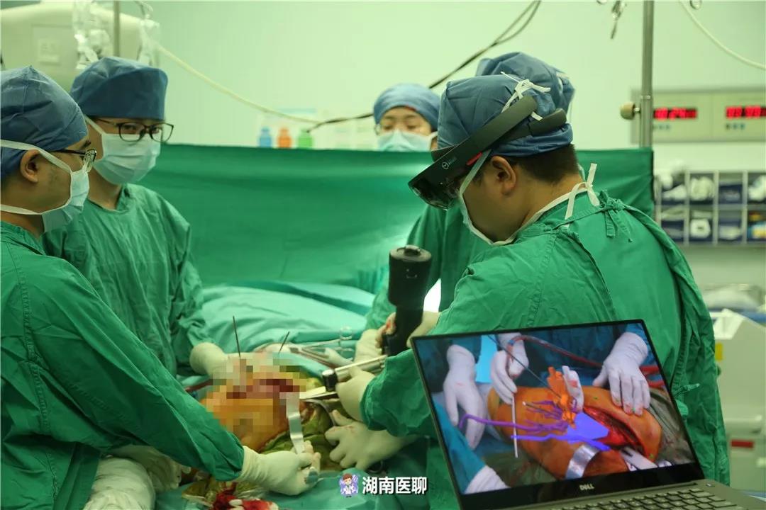 3D打印黑科技