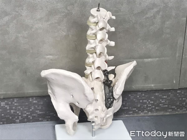 3D打印出的医材