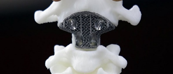骨骼3D打印机