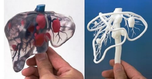 3D打印仿生胰腺