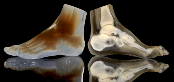3d打印机打印人体骨骼模型