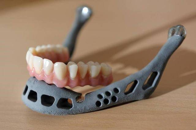 3D打印机医疗应用