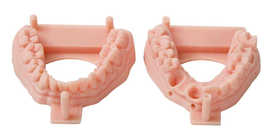 3D打印机牙套